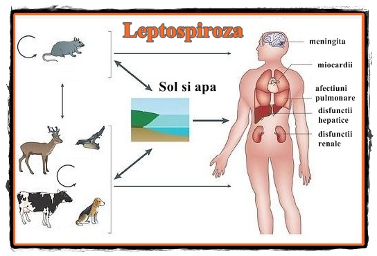 Leptospiroza
